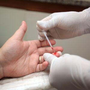 cura do HIV
