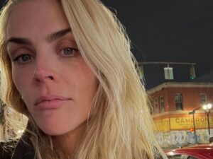 Atriz de As Branquelas, Busy Philipps, revela tumor cerebral e cirurgias